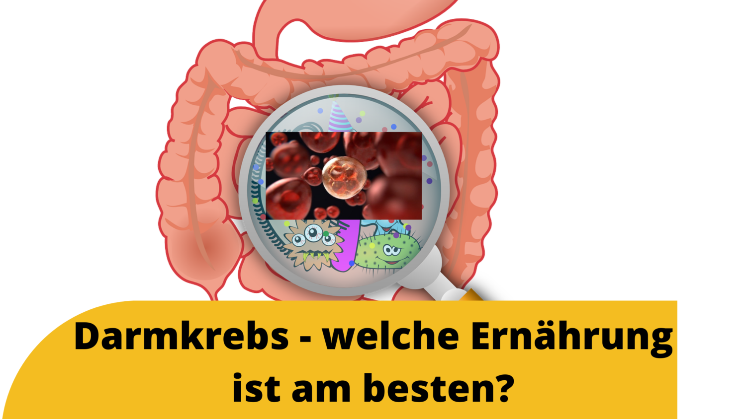 Darmkrebs - Welche Ernährung Ist Am Besten_ - VITALECK - Fortbildungsportal